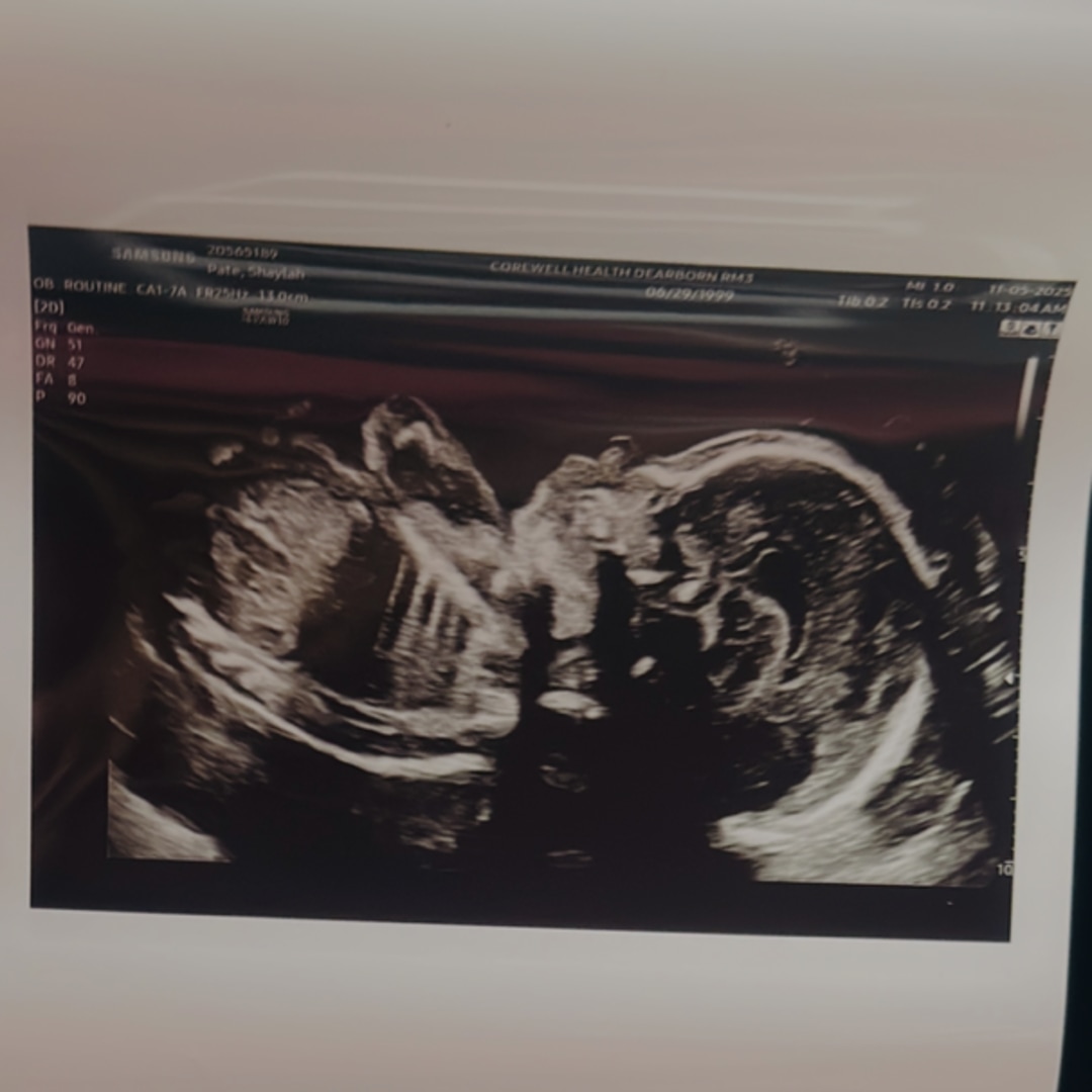 Photo shared by Chris for their Babylist baby registry.