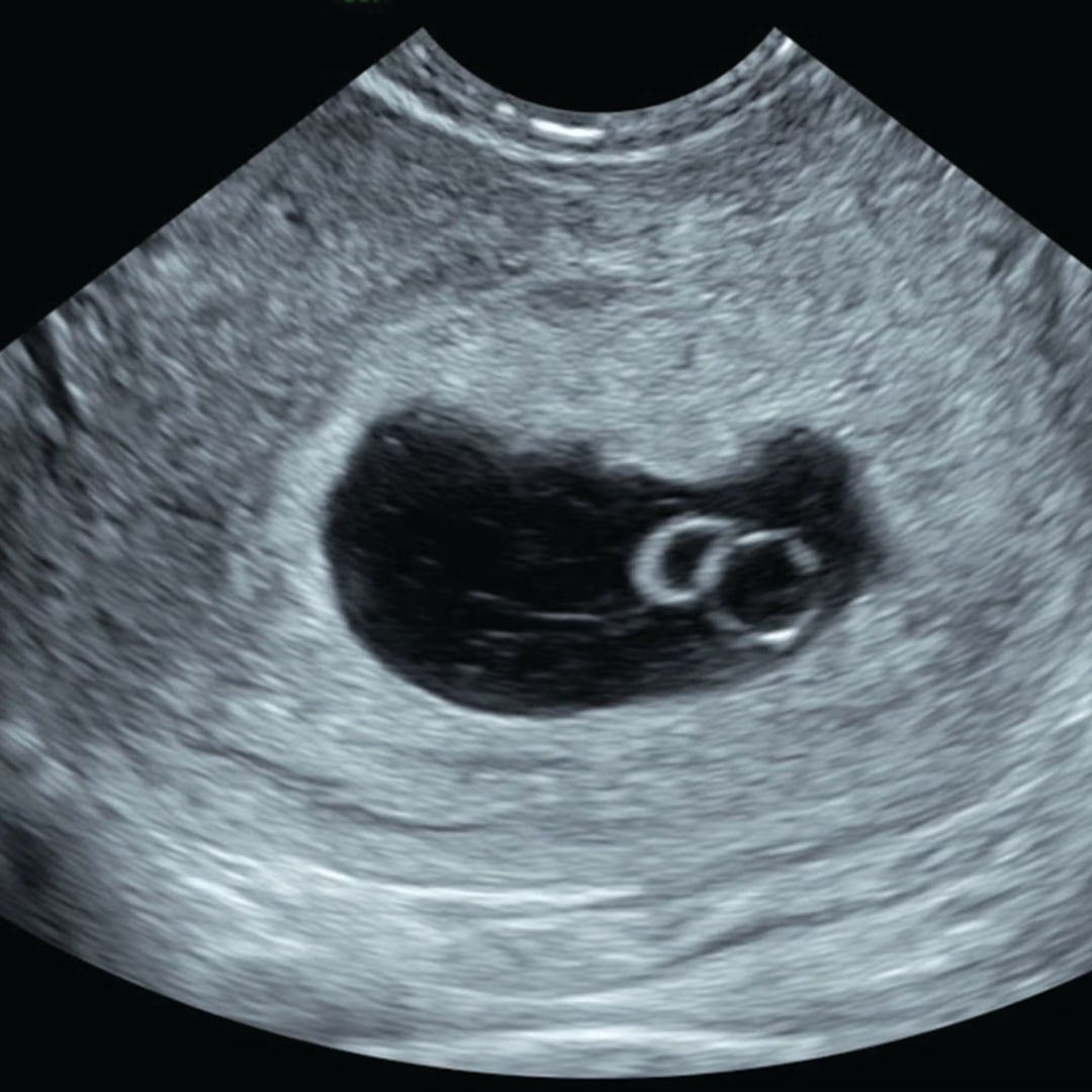 Photo shared by Kimberly for their Babylist baby registry.