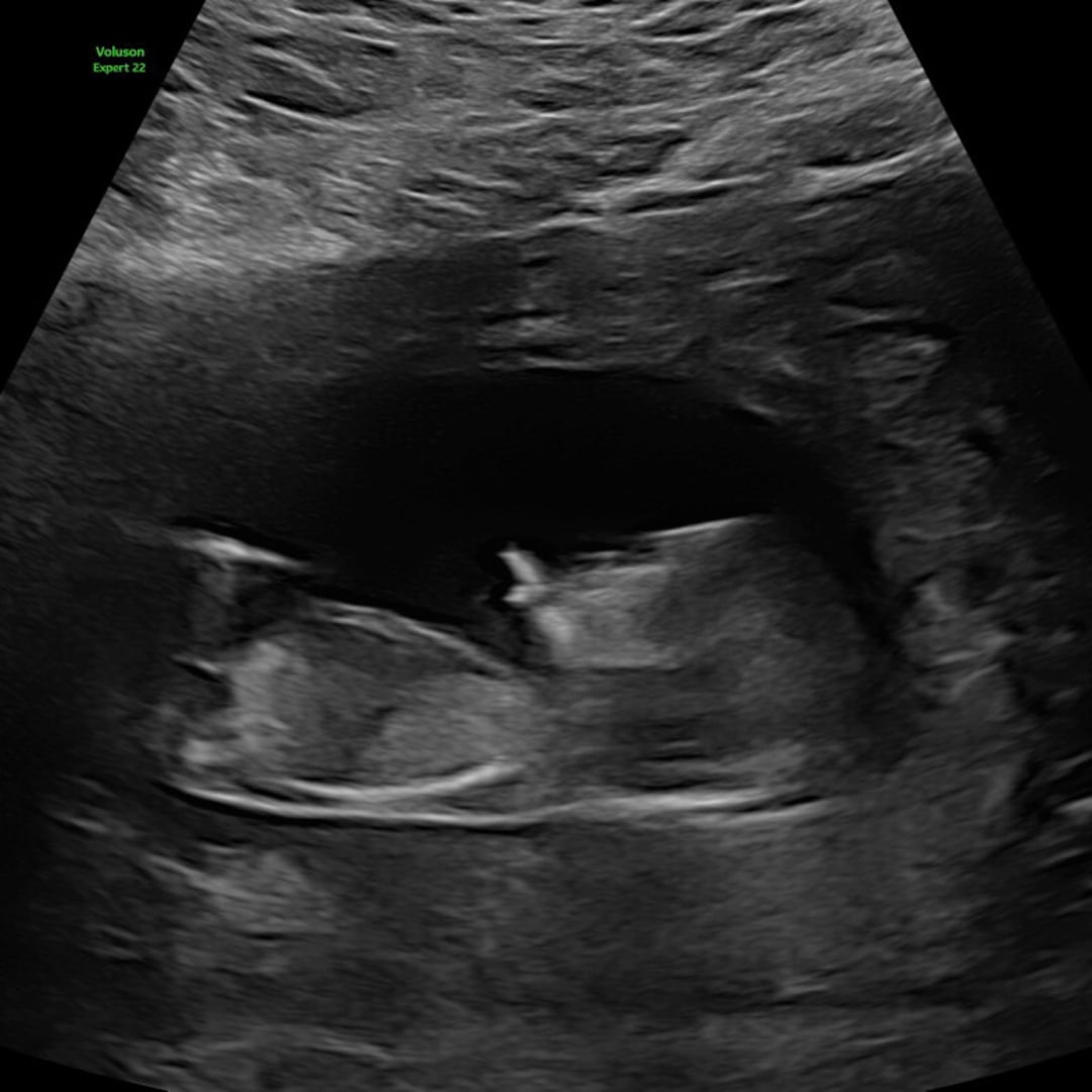 Photo shared by Rico for their Babylist baby registry.