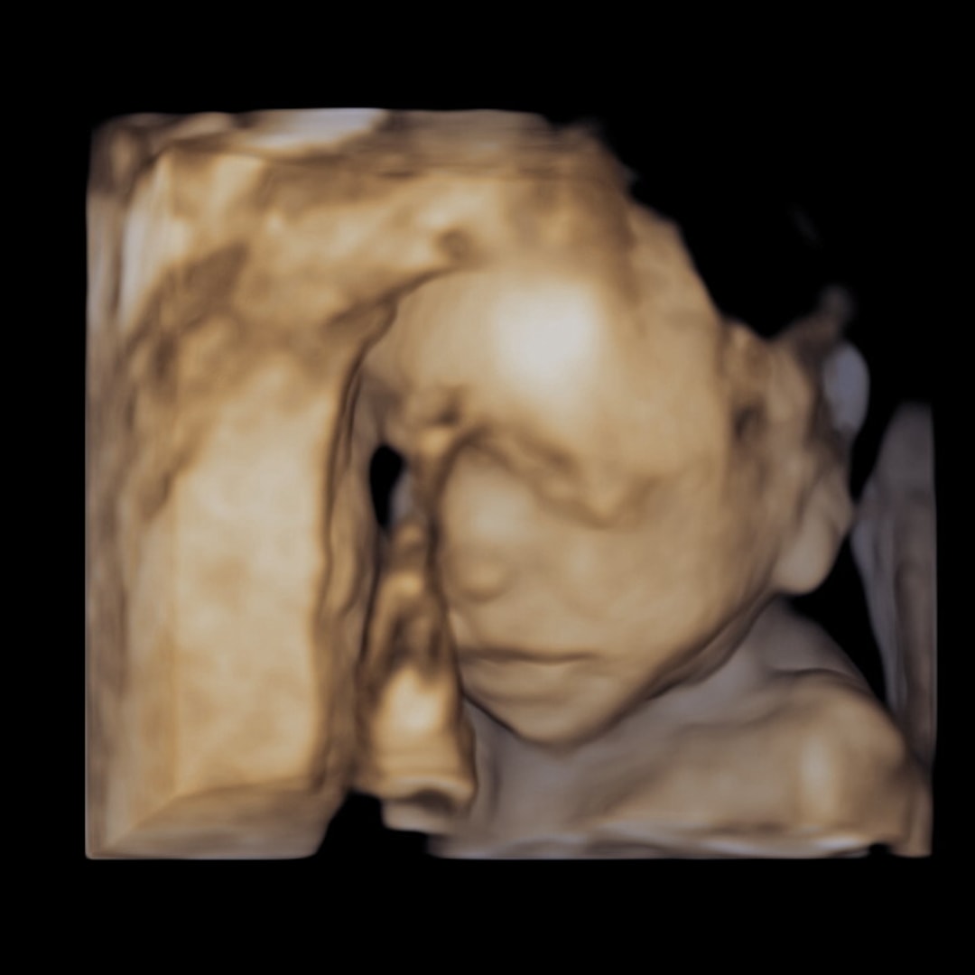 Photo shared by Brittany for their Babylist baby registry.