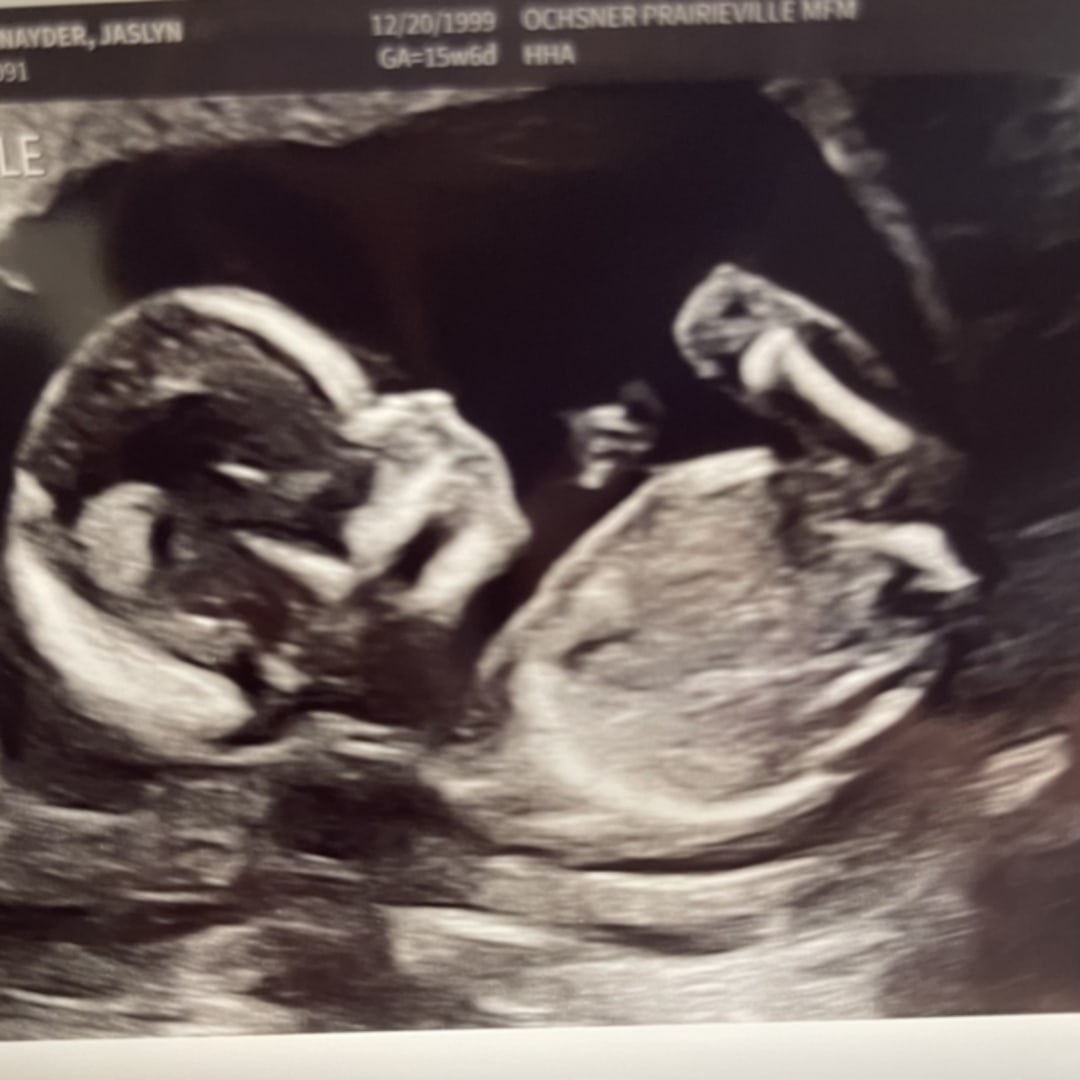 Photo shared by Jaslyn for their Babylist baby registry.