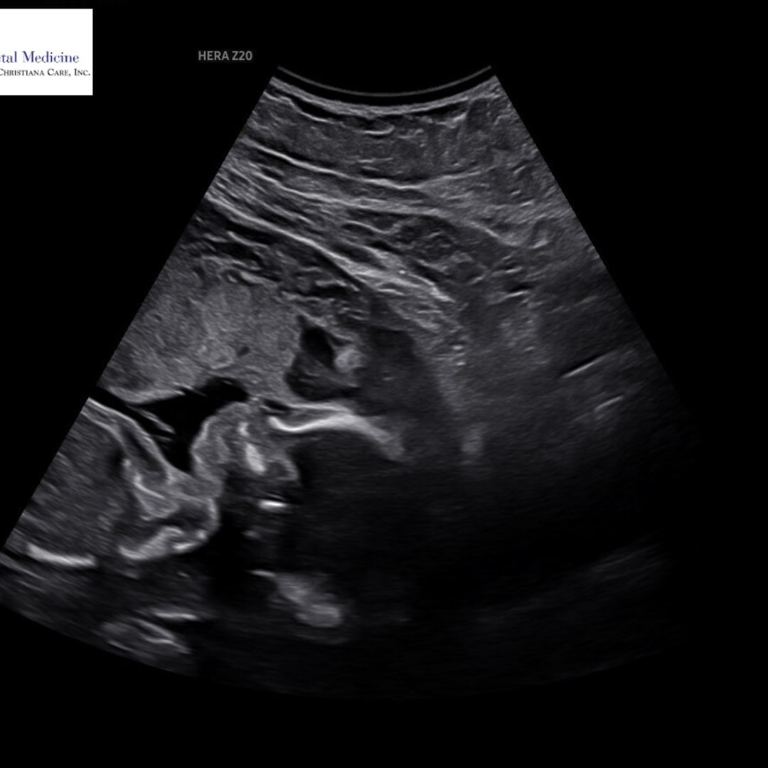 Photo shared by Leslie for their Babylist baby registry.