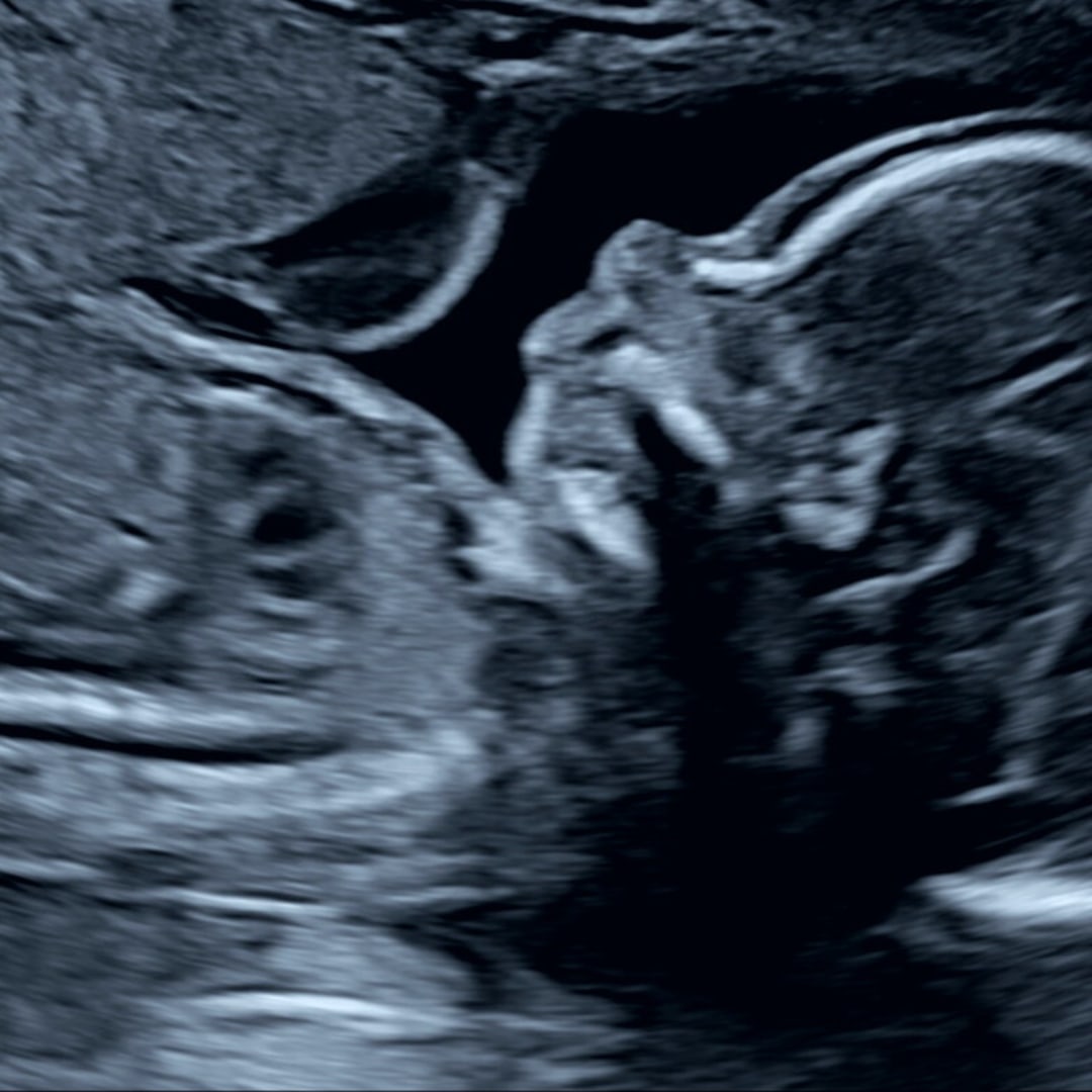 Photo shared by Ellie for their Babylist baby registry.