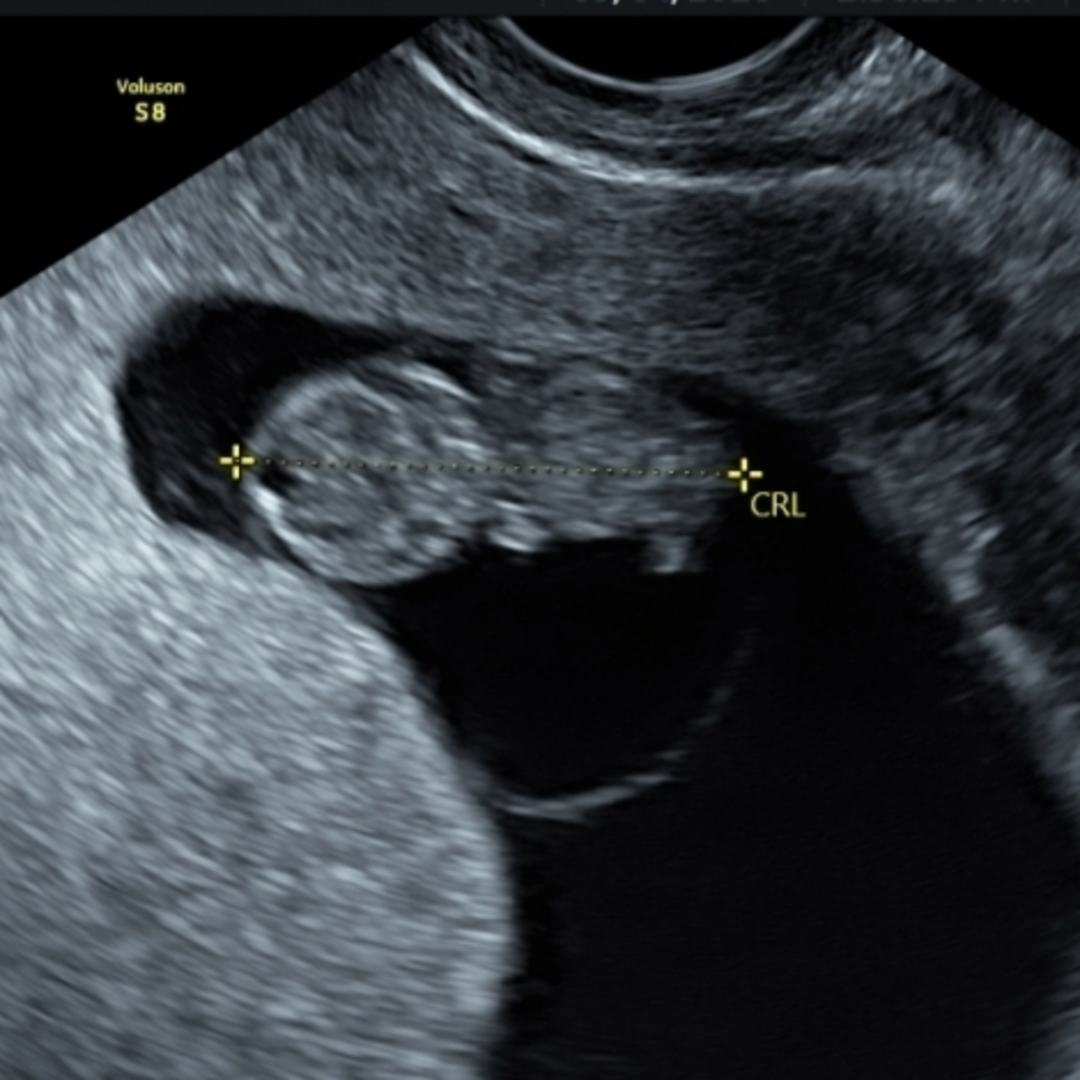 Photo shared by Courtney for their Babylist baby registry.