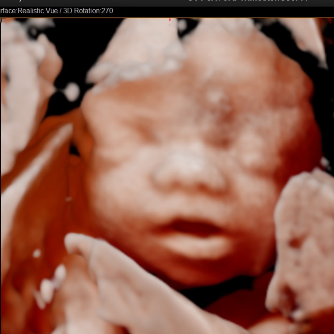 Photo shared by Montana for their Babylist baby registry.