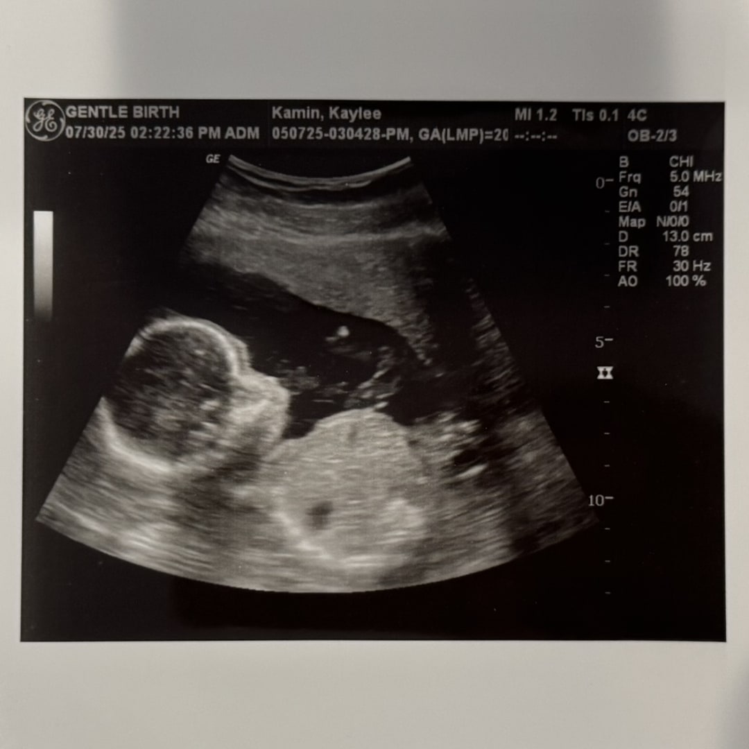 Photo shared by Kaylee for their Babylist baby registry.