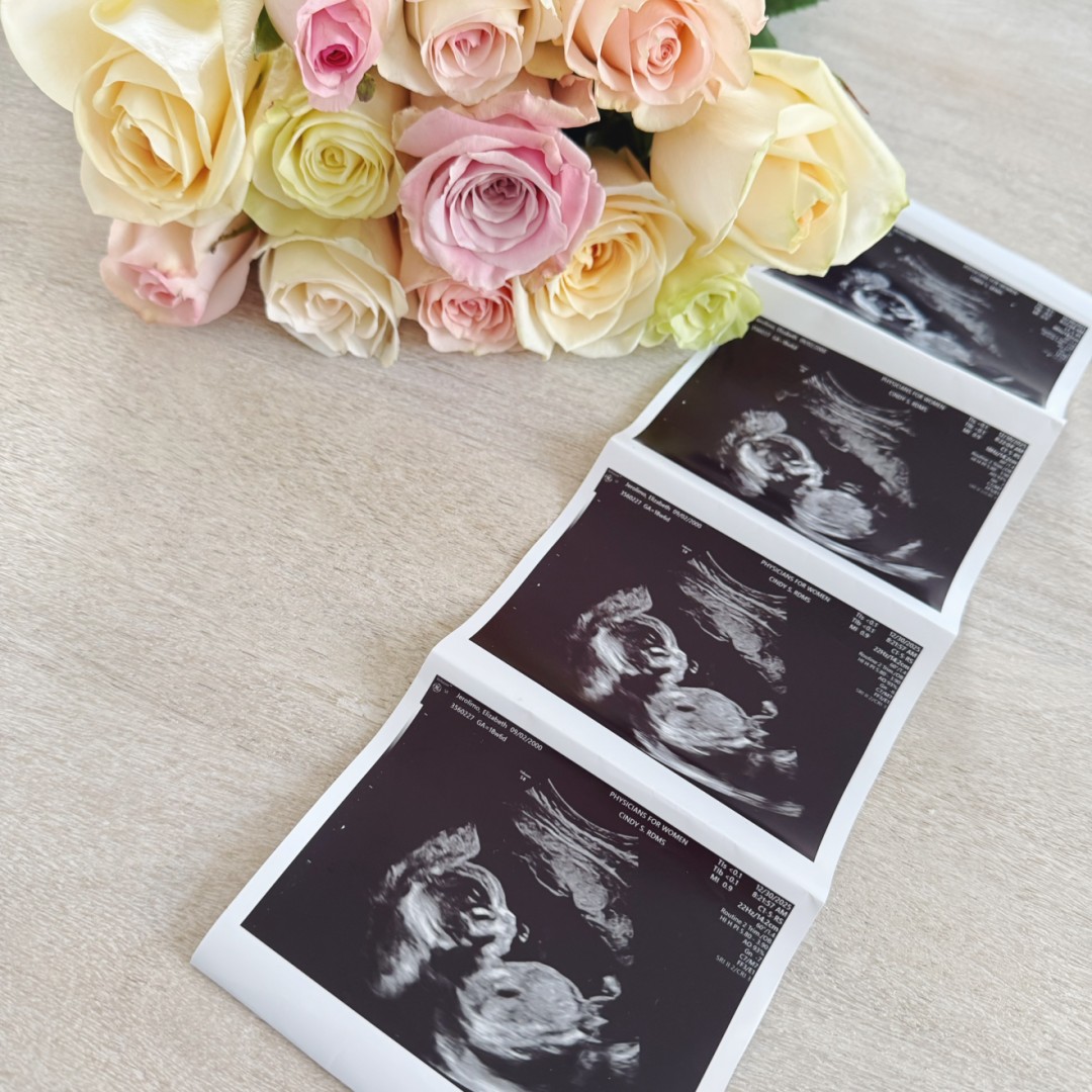 Photo shared by Elizabeth for their Babylist baby registry.