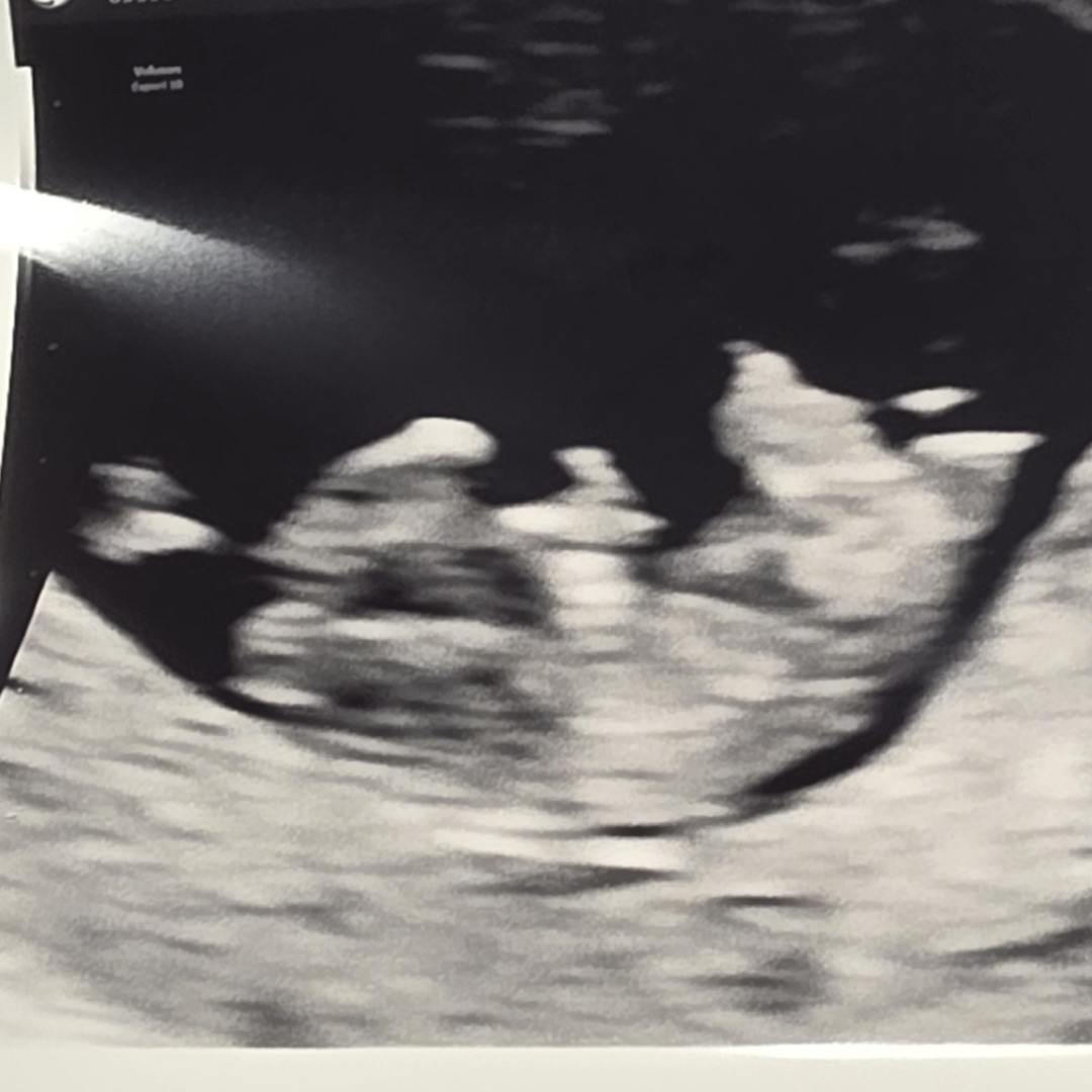 Photo shared by Kaitlin for their Babylist baby registry.