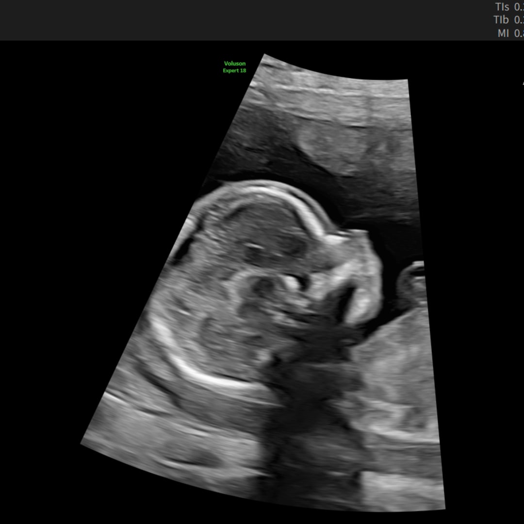 Photo shared by Amanda for their Babylist baby registry.