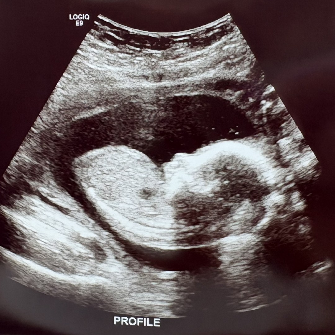 Photo shared by Alexandrea for their Babylist baby registry.