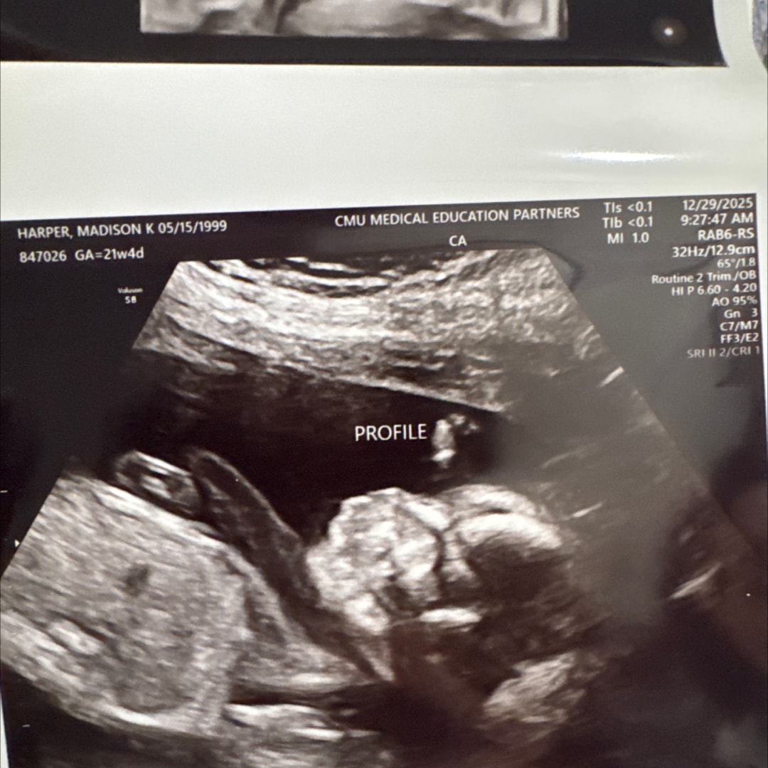 Photo shared by Maddie for their Babylist baby registry.