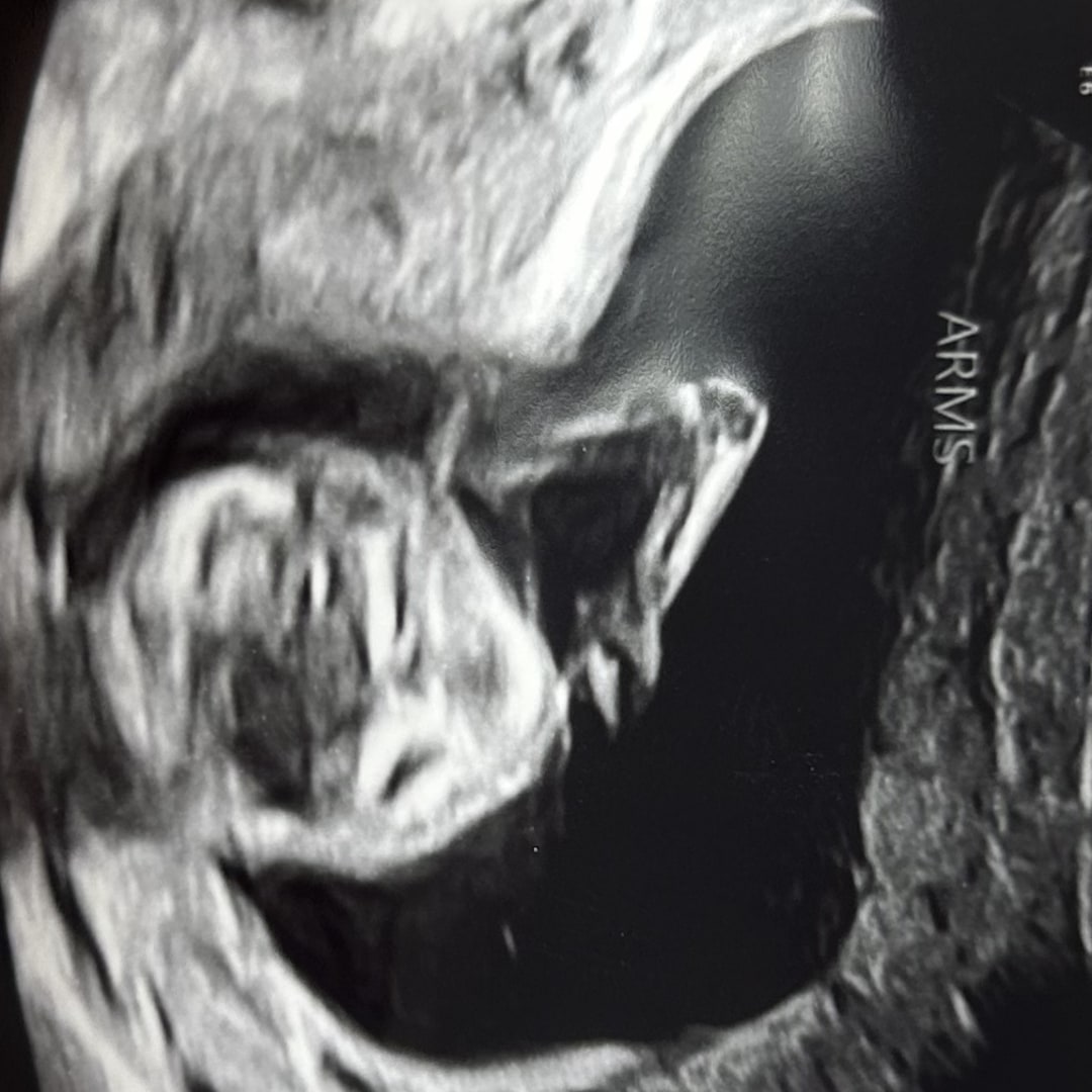 Photo shared by Ashby Grace for their Babylist baby registry.