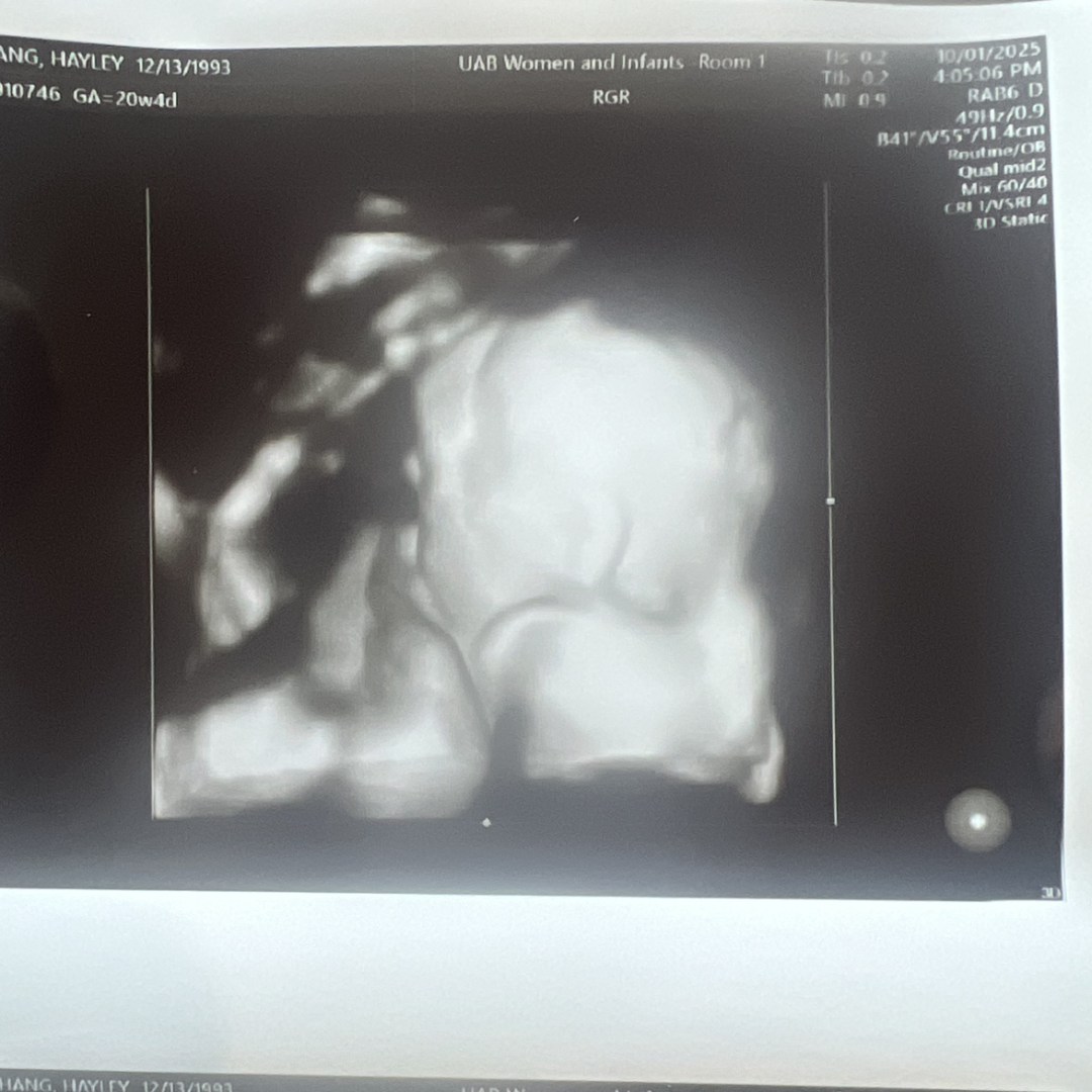 Photo shared by Hayley for their Babylist baby registry.