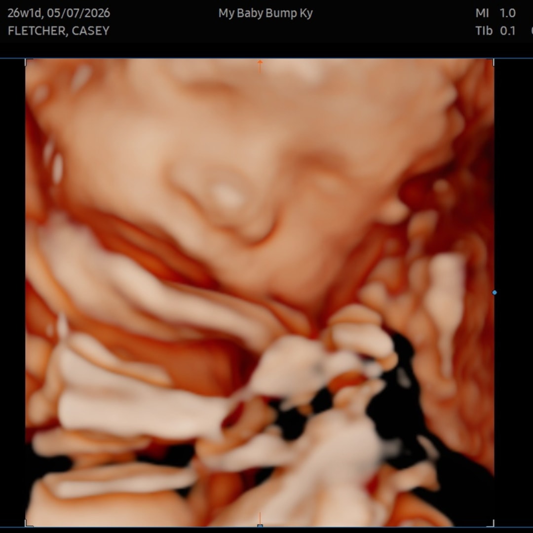 Photo shared by Casey for their Babylist baby registry.