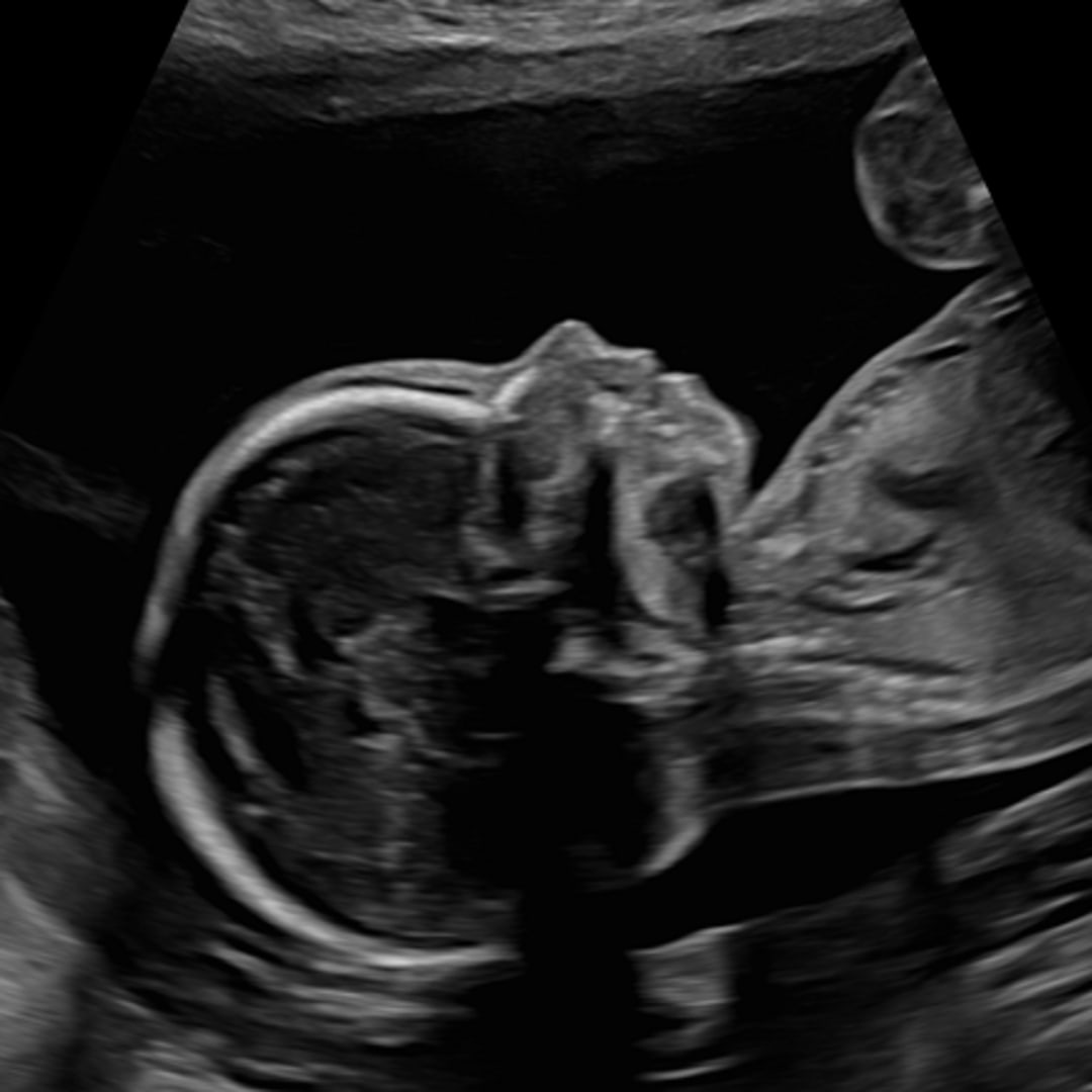 Photo shared by Margeaux for their Babylist baby registry.