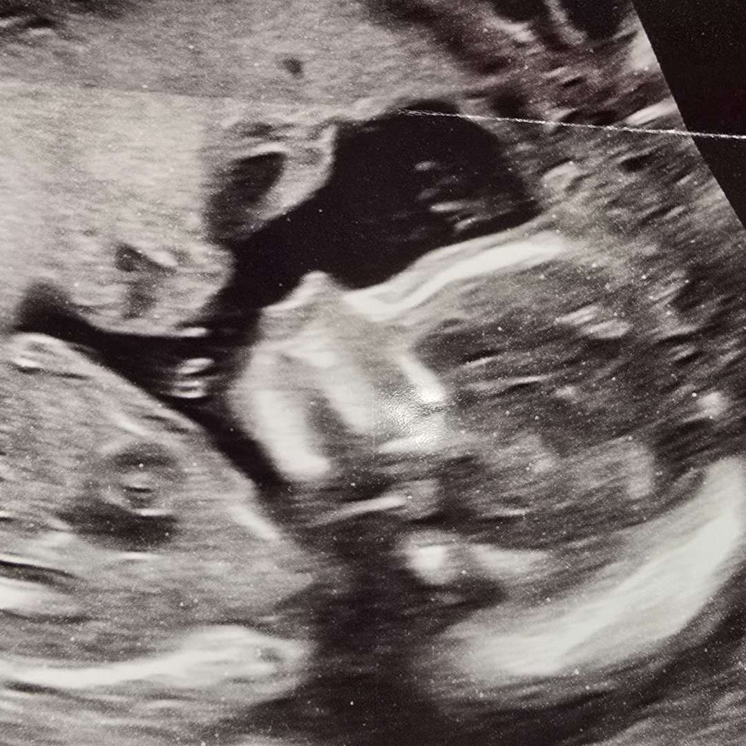 Photo shared by Gracie for their Babylist baby registry.