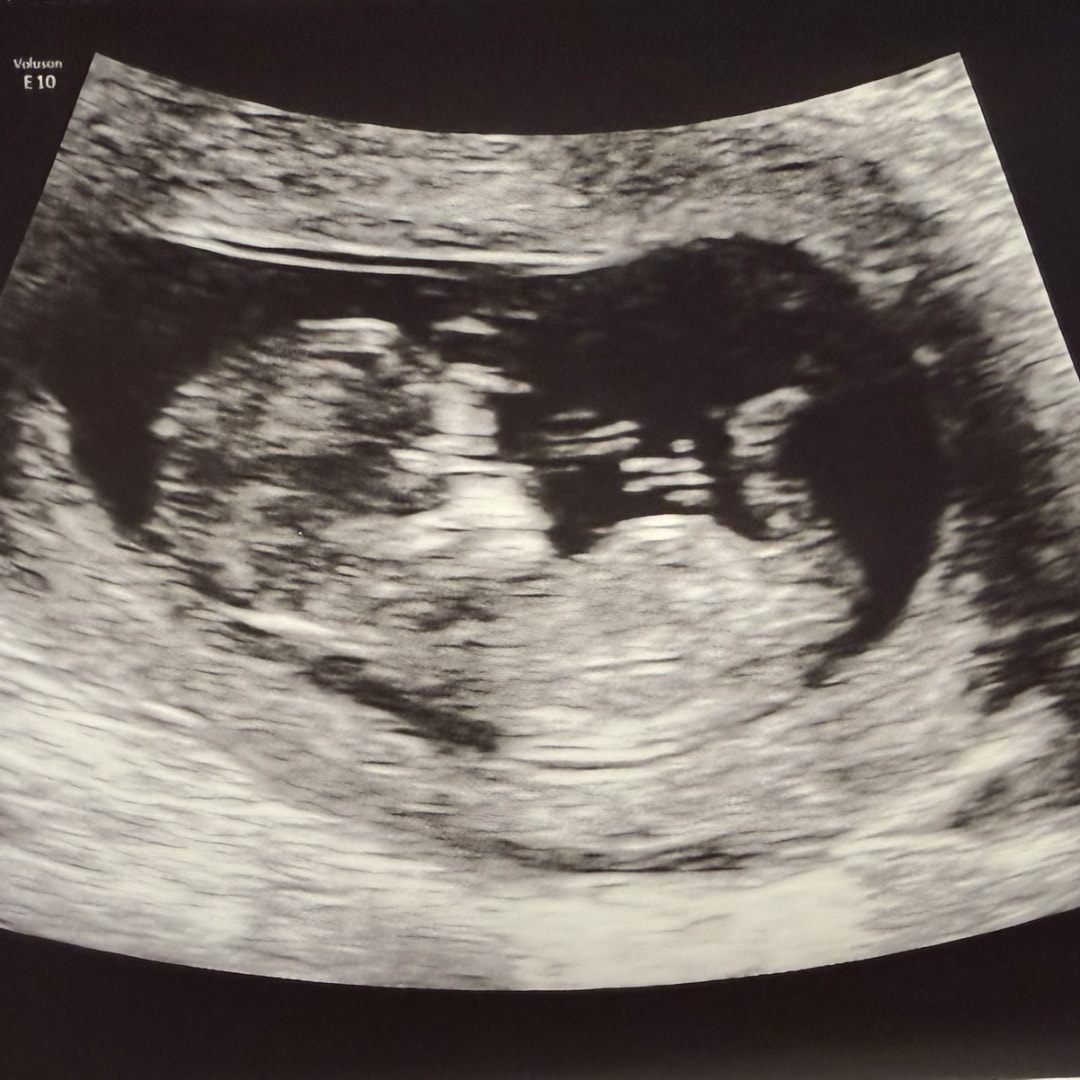 Photo shared by Ashleigh for their Babylist baby registry.