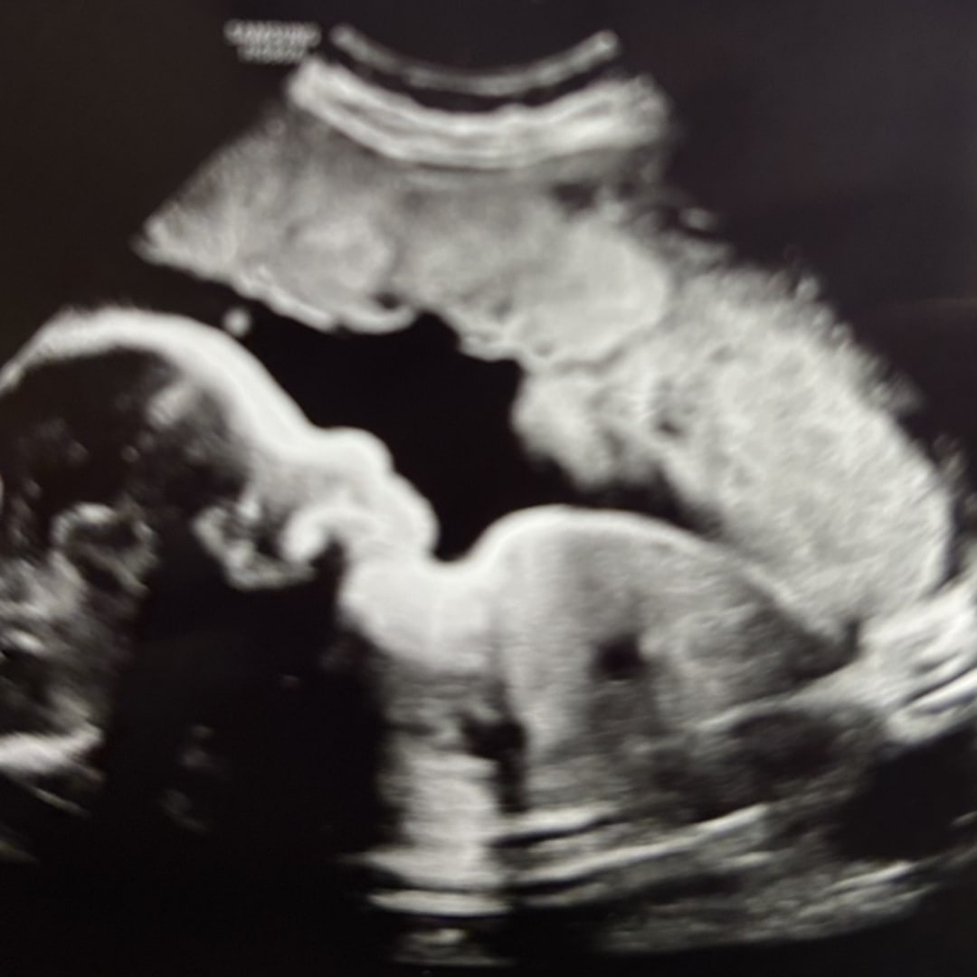 Photo shared by Kalicia for their Babylist baby registry.