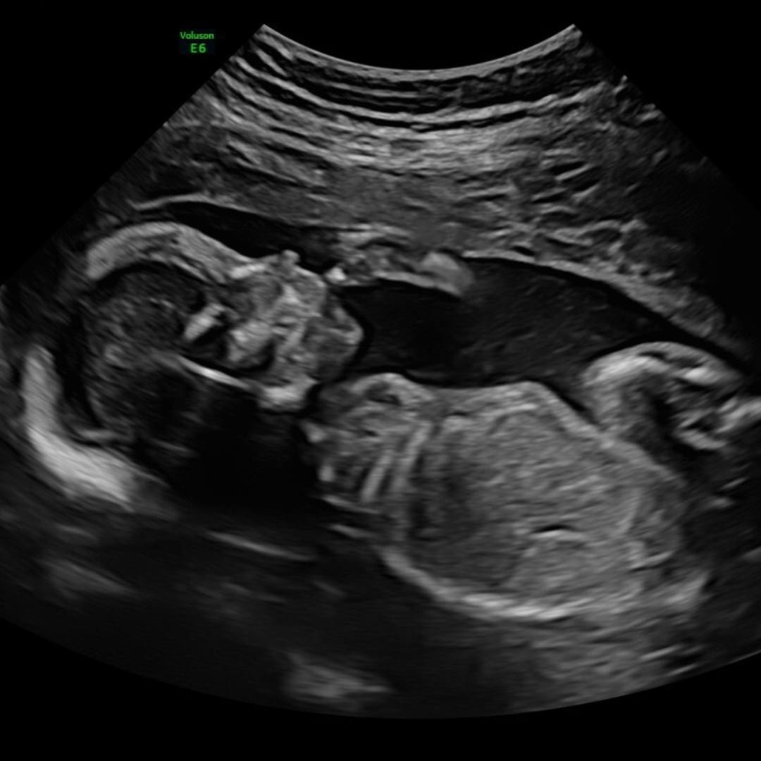 Photo shared by Bri for their Babylist baby registry.