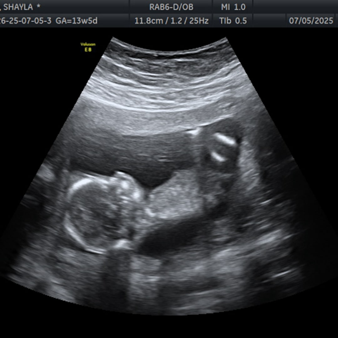 Photo shared by Shayla for their Babylist baby registry.