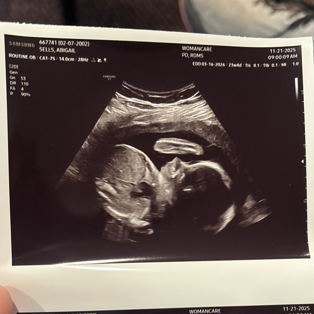 Photo shared by Abby for their Babylist baby registry.