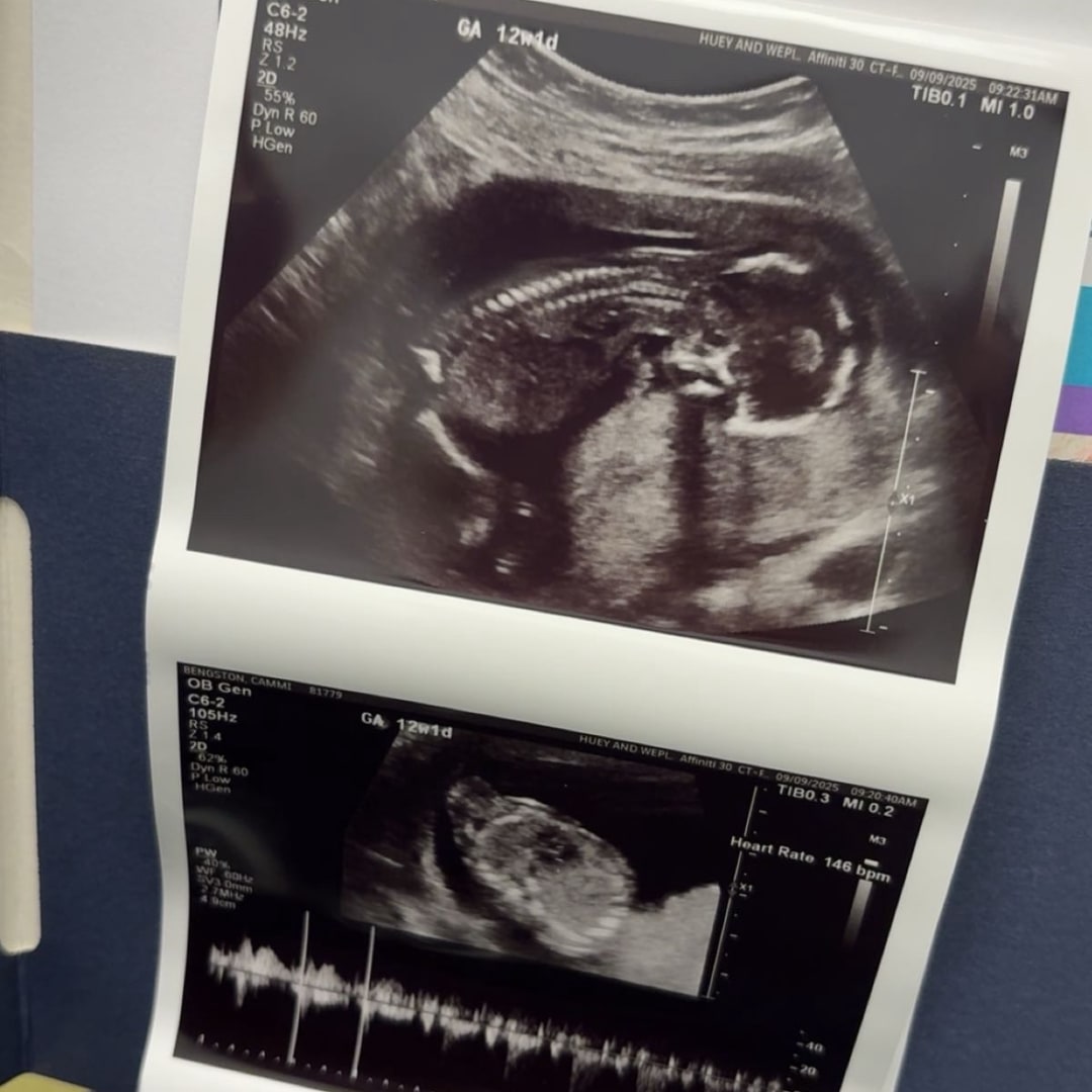 Photo shared by Cammi for their Babylist baby registry.