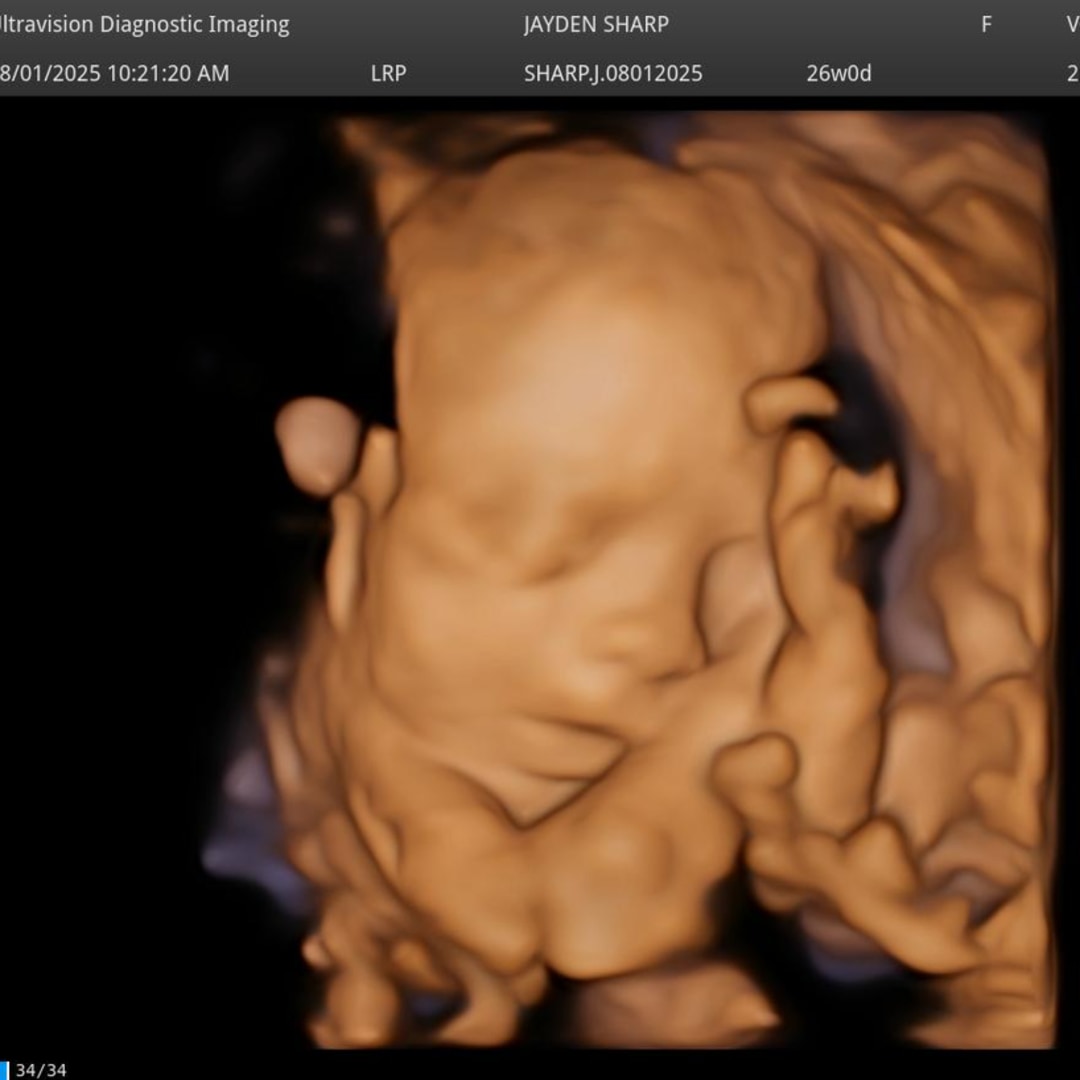Photo shared by Jayden for their Babylist baby registry.