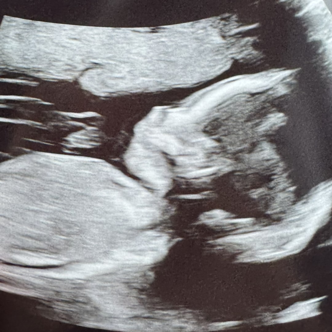 Photo shared by Alie for their Babylist baby registry.