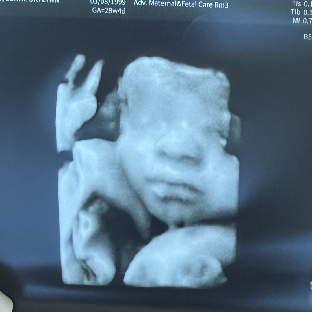 Photo shared by Jenae for their Babylist baby registry.