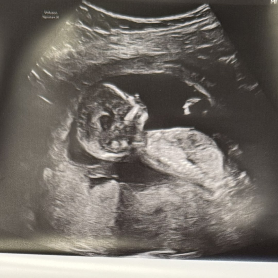 Photo shared by Ahreanna for their Babylist baby registry.