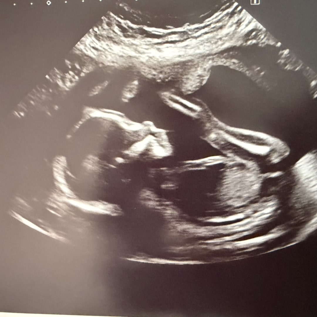 Photo shared by Daisy for their Babylist baby registry.