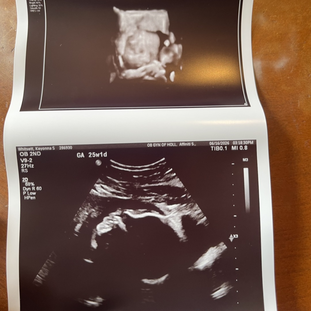 Photo shared by Keyonna for their Babylist baby registry.