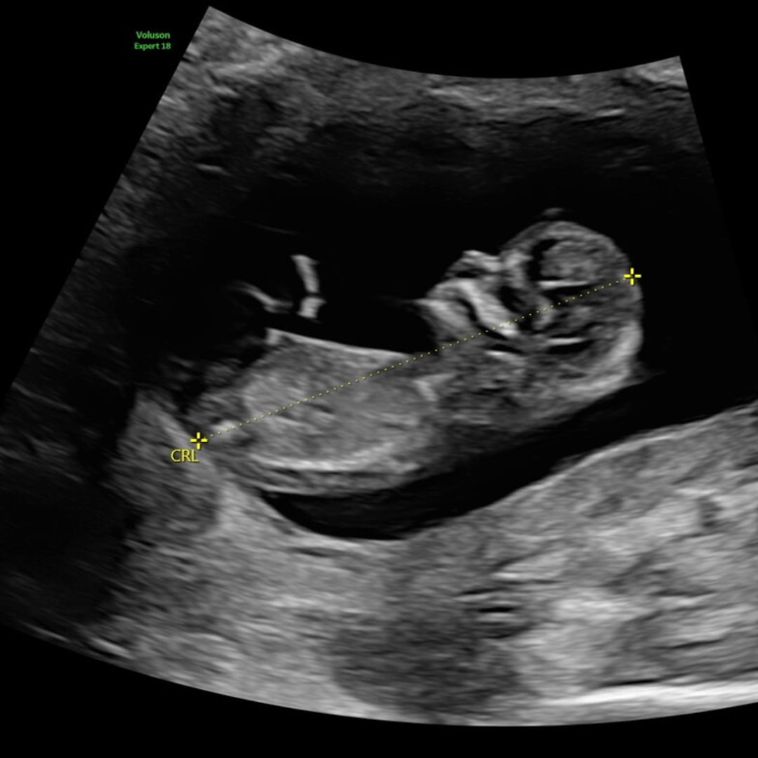 Photo shared by Chana for their Babylist baby registry.