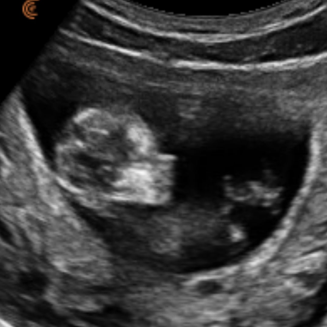 Photo shared by Desani for their Babylist baby registry.