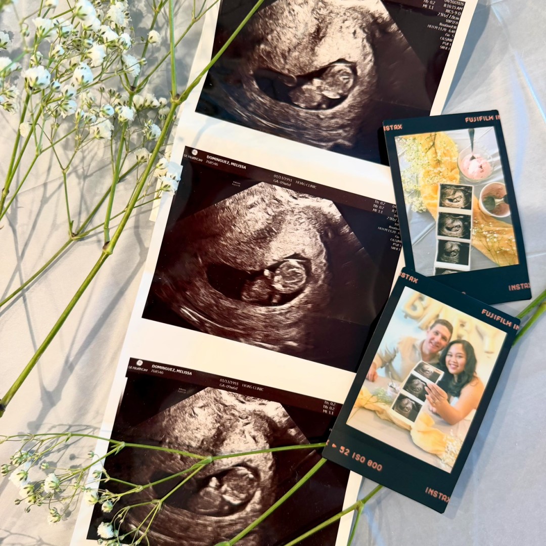 Photo shared by Melissa for their Babylist baby registry.