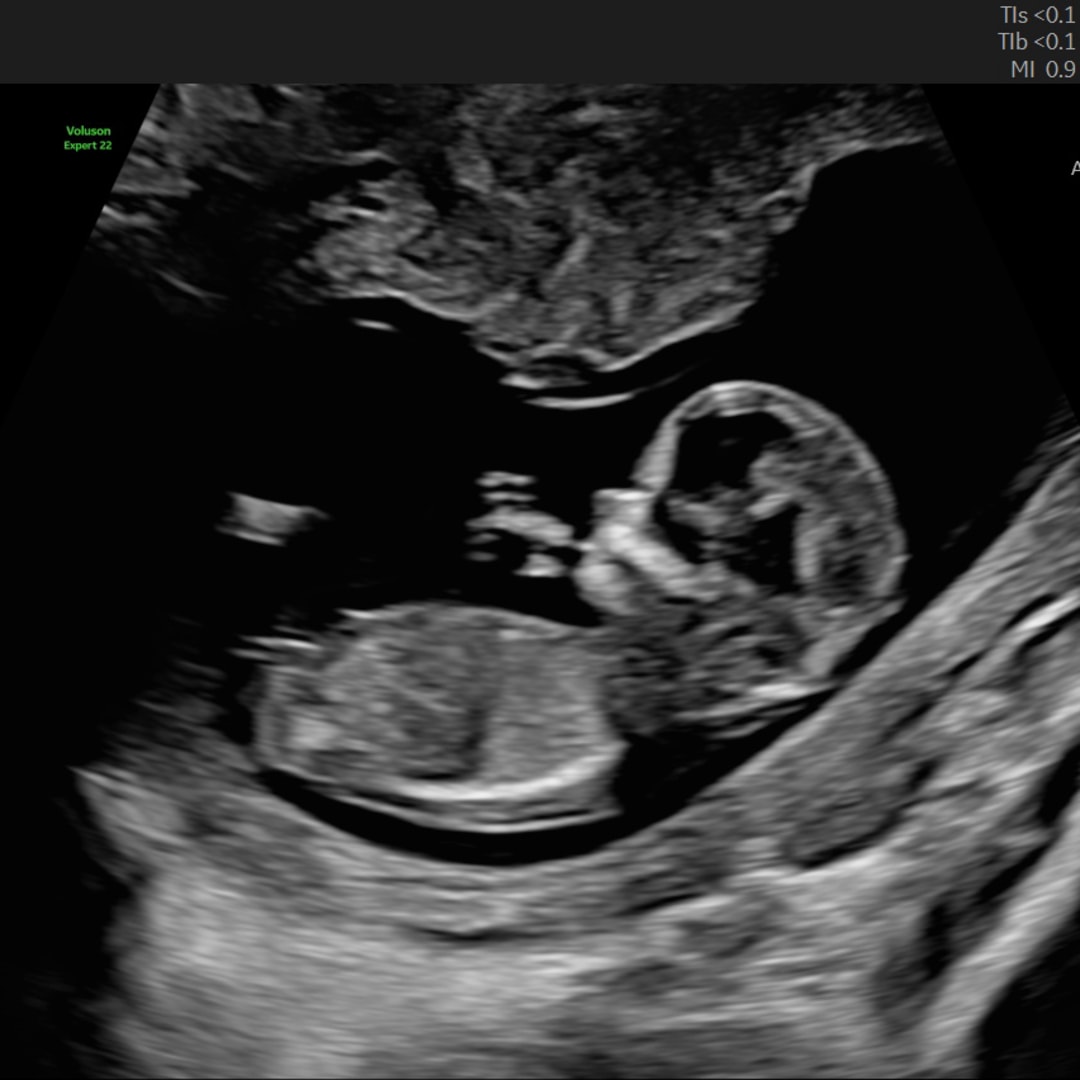 Photo shared by Hannah for their Babylist baby registry.