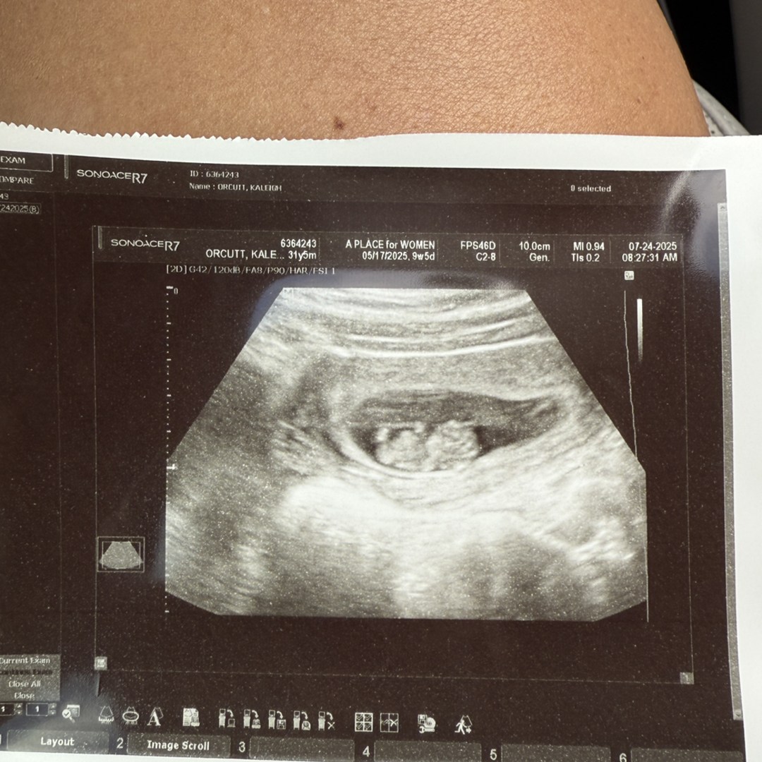 Photo shared by Kaleigh for their Babylist baby registry.