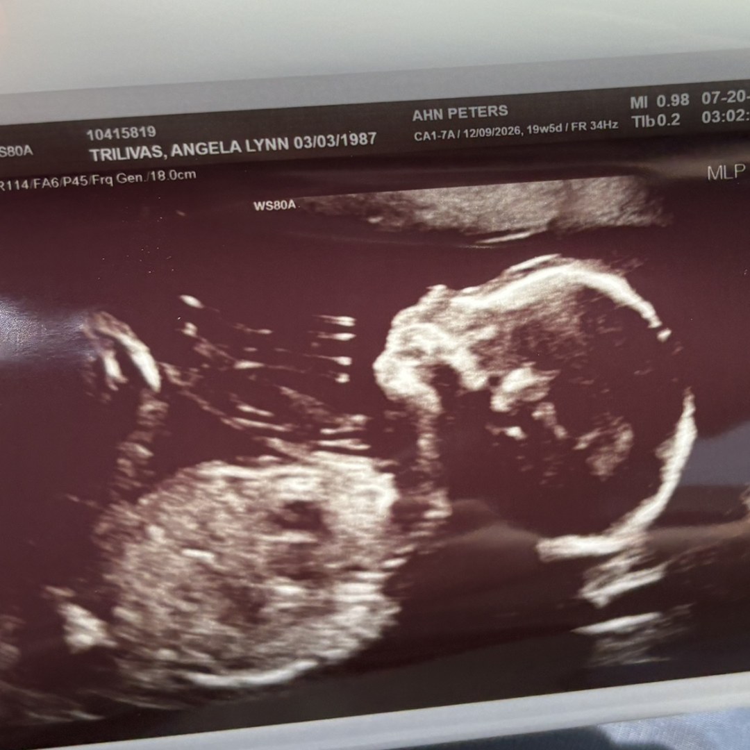 Photo shared by Angela for their Babylist baby registry.