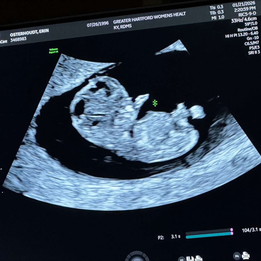 Photo shared by Erin for their Babylist baby registry.