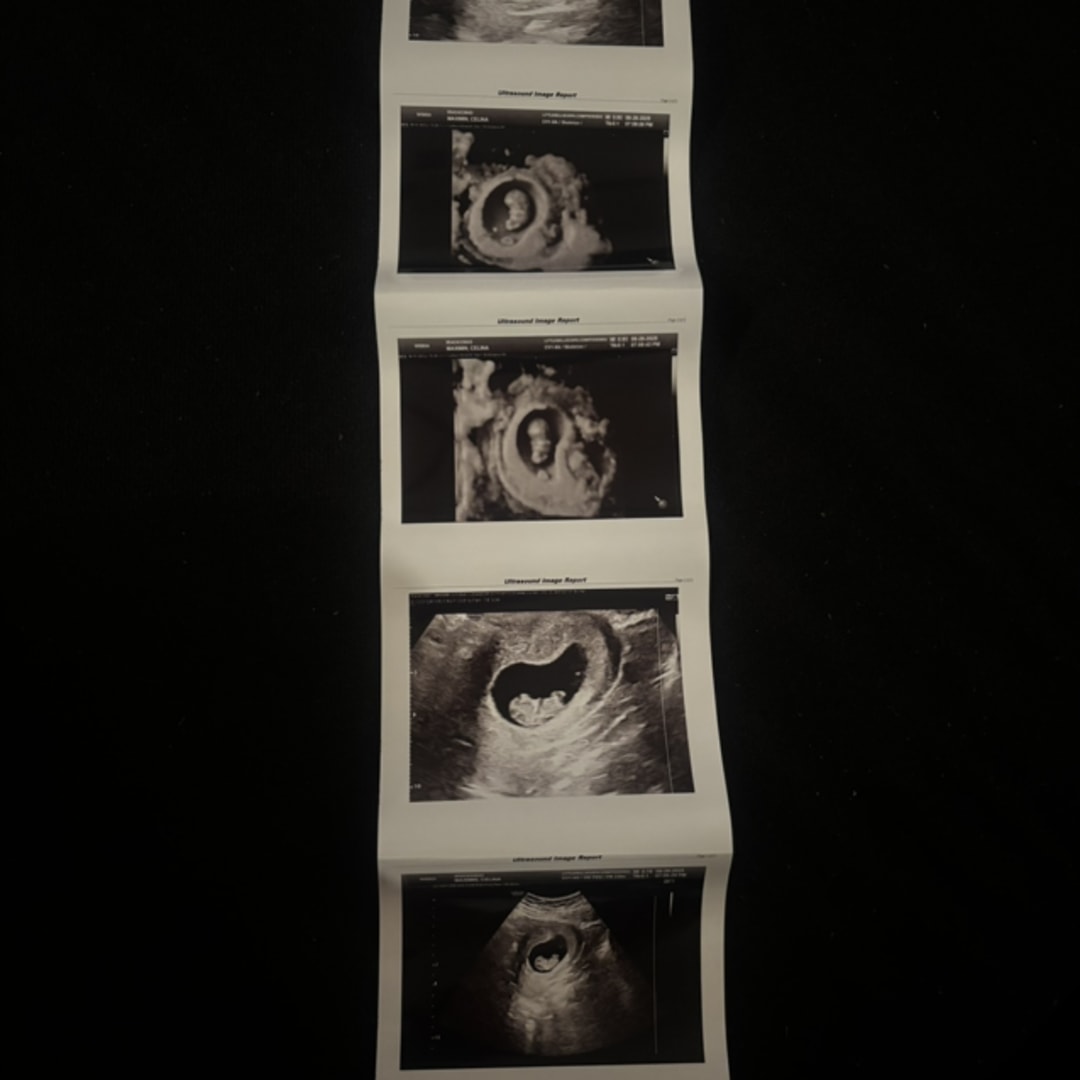 Photo shared by Celina for their Babylist baby registry.