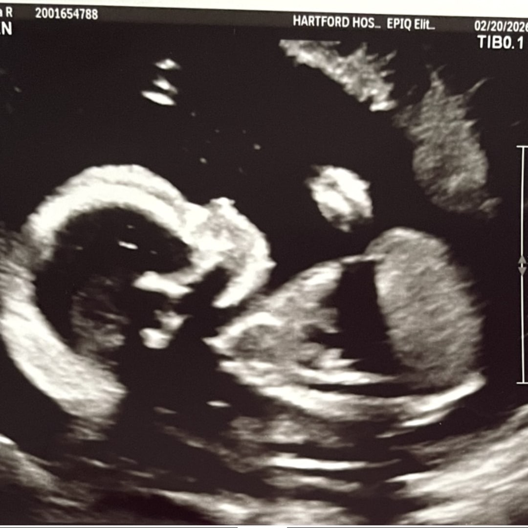 Photo shared by Jenicia for their Babylist baby registry.