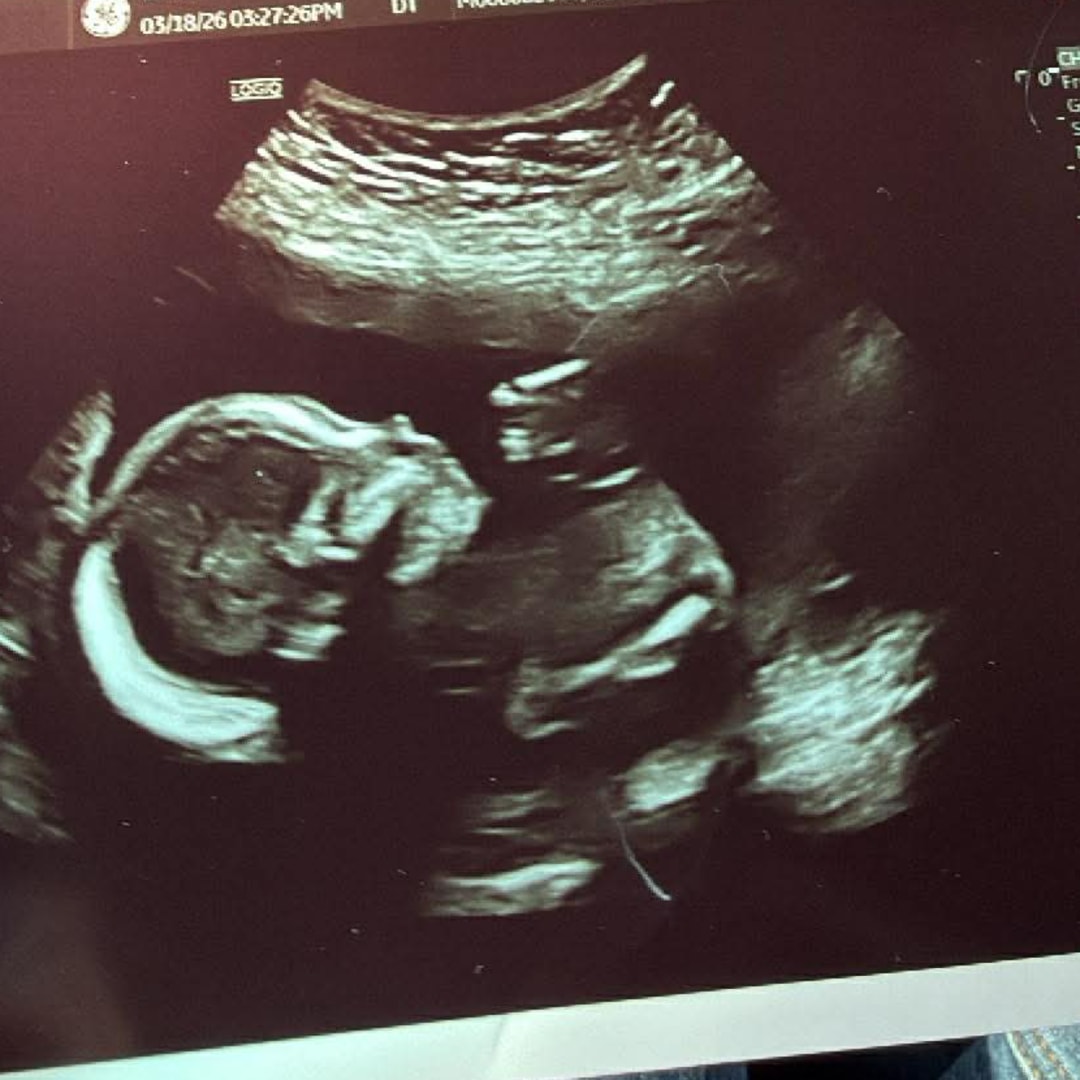 Photo shared by Emily for their Babylist baby registry.