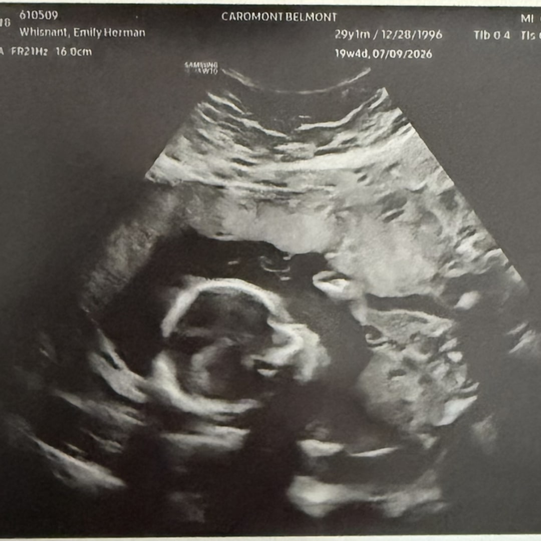 Photo shared by Emily for their Babylist baby registry.