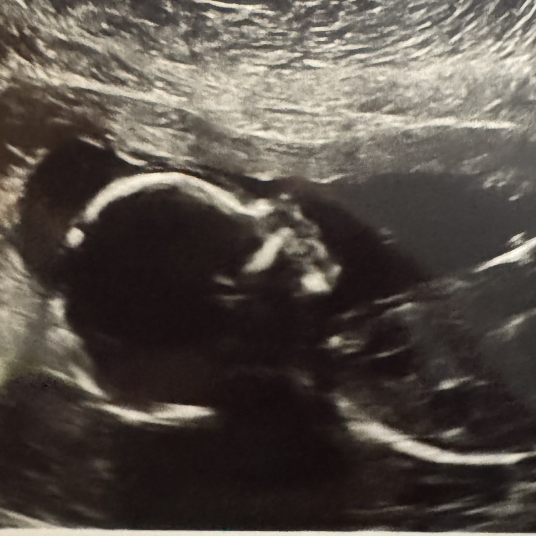 Photo shared by Cora for their Babylist baby registry.