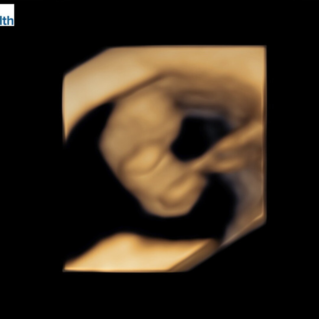 Photo shared by Eastlyn for their Babylist baby registry.