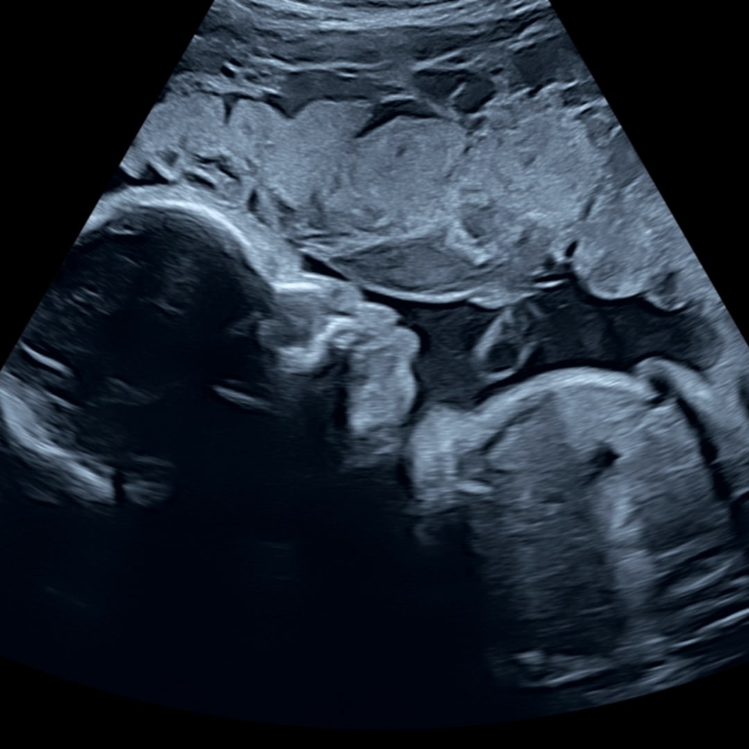 Photo shared by Franciris for their Babylist baby registry.