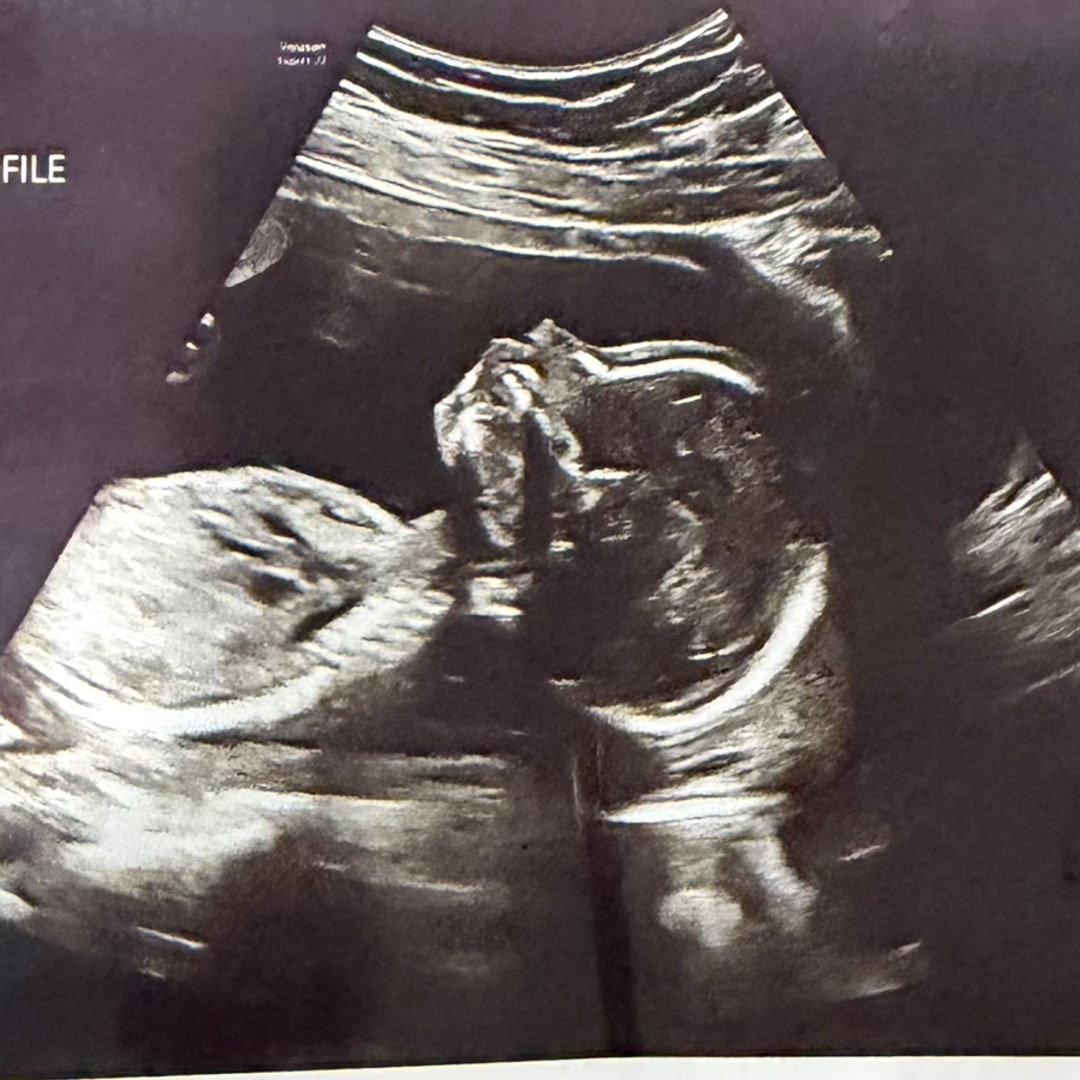 Photo shared by Yari for their Babylist baby registry.