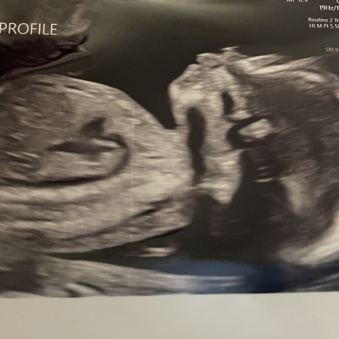 Photo shared by Makayla for their Babylist baby registry.