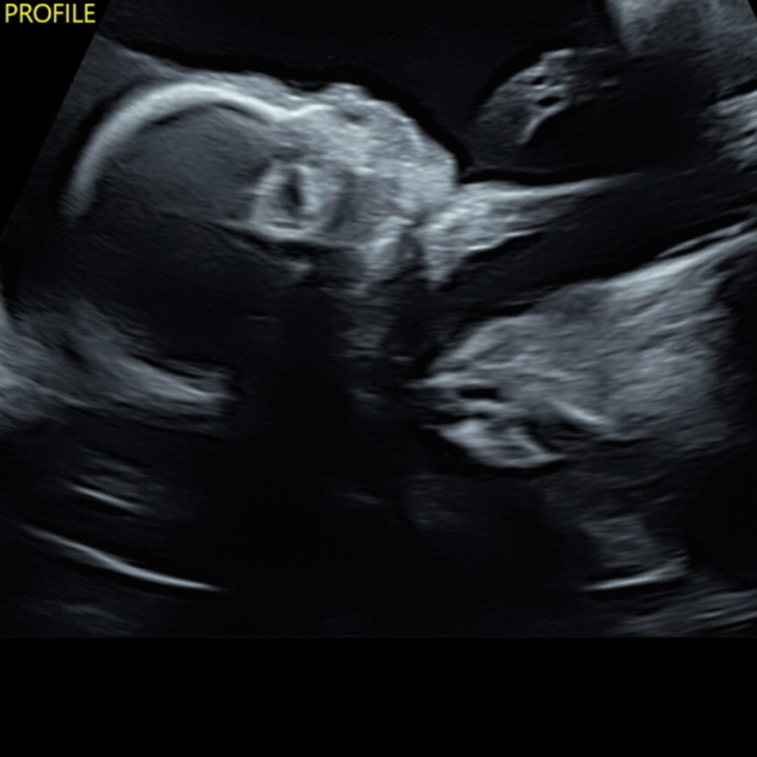 Photo shared by Meghan for their Babylist baby registry.