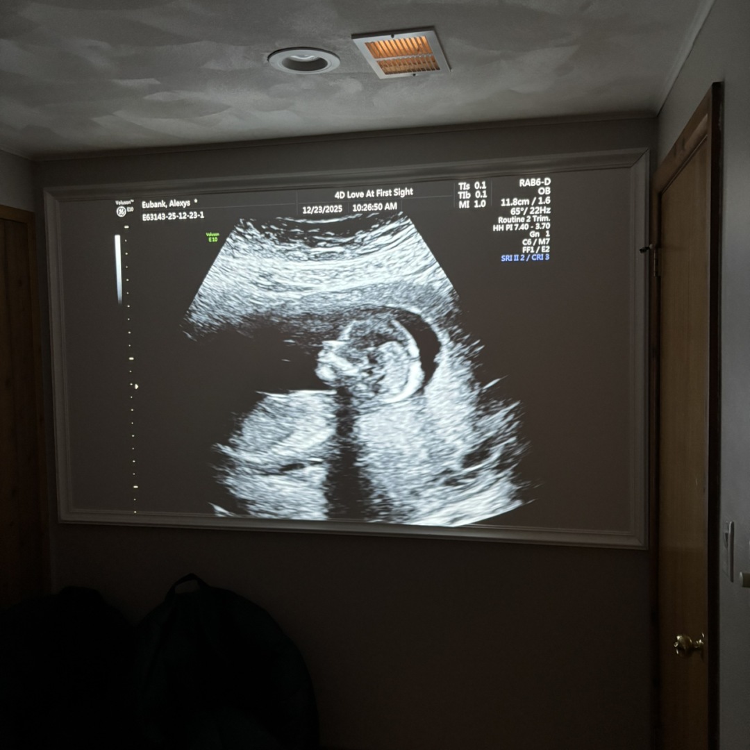 Photo shared by Alexys for their Babylist baby registry.